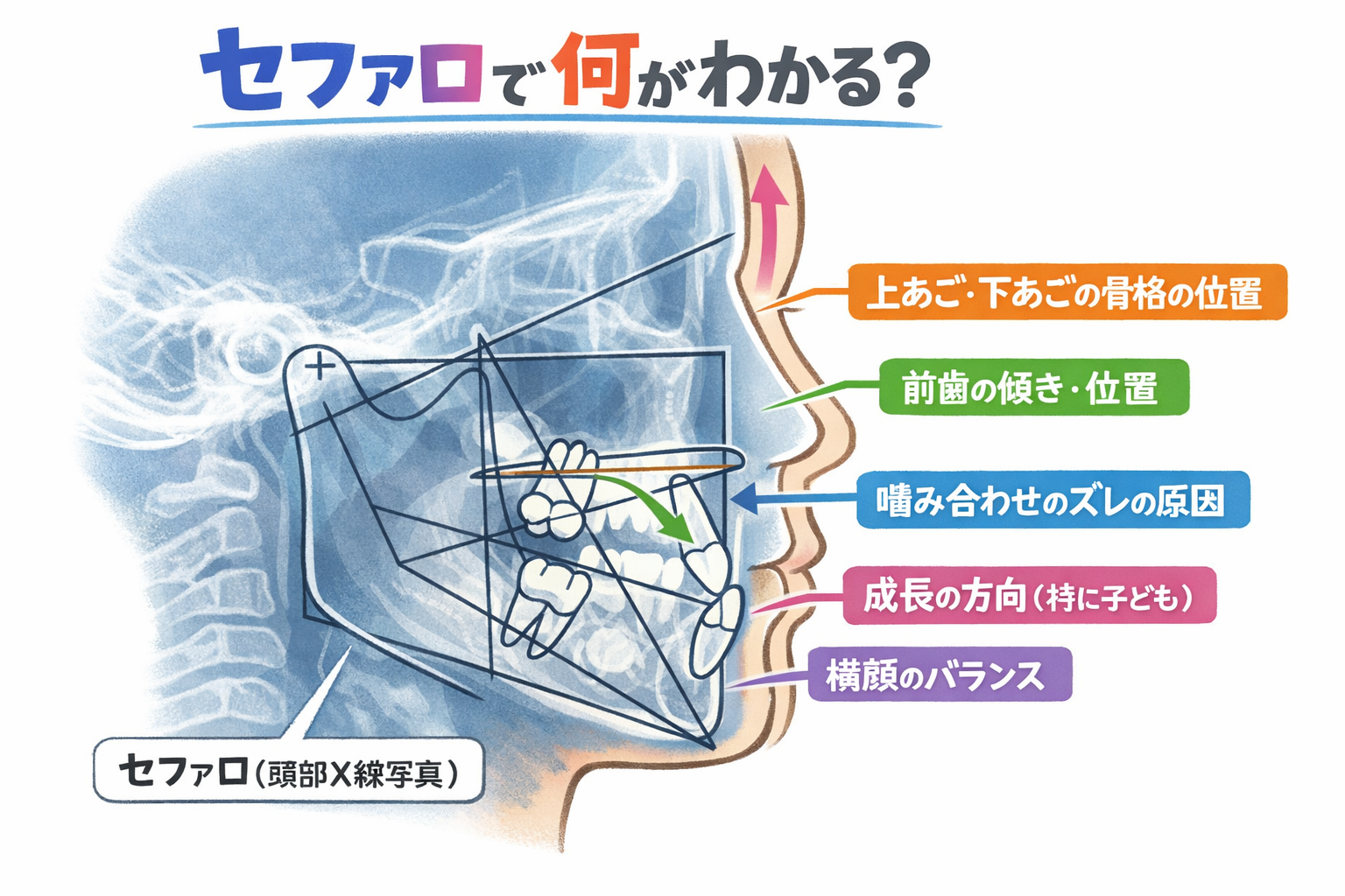 「歯を抜かない矯正でセファロ（セファログラム）が重要な理由｜非抜歯矯正の精密診断」