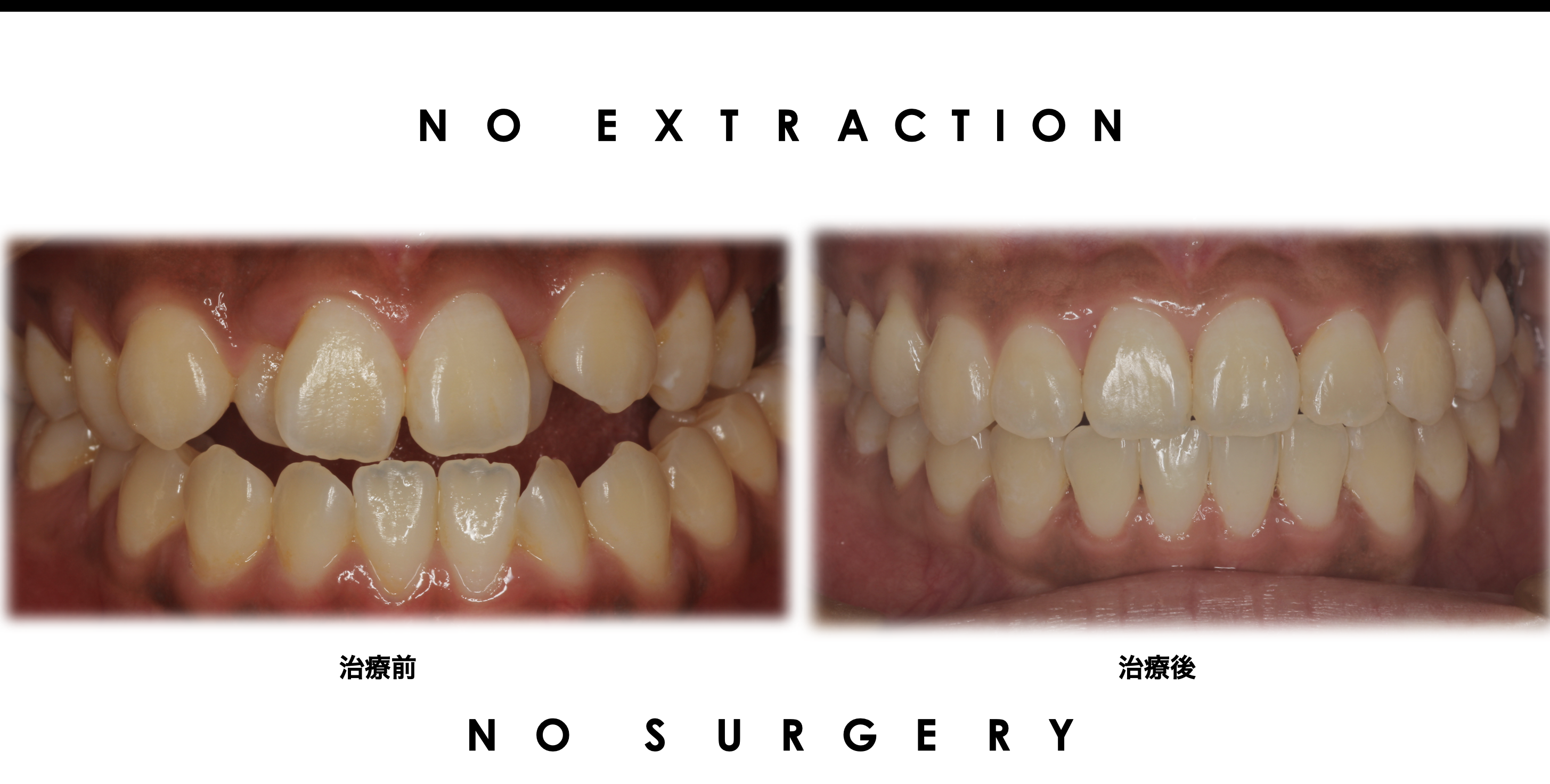 抜かない矯正　院長のこだわり