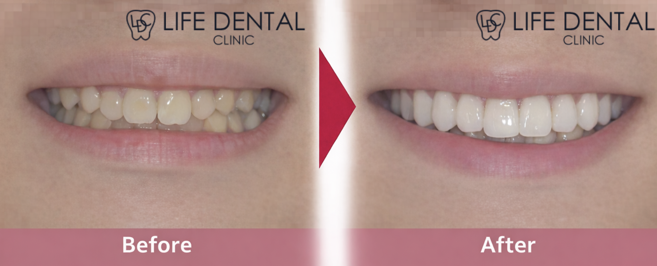 日本歯科審美学会認定医が行う審美歯科・矯正治療｜見た目と噛み合わせを両立する治療とは